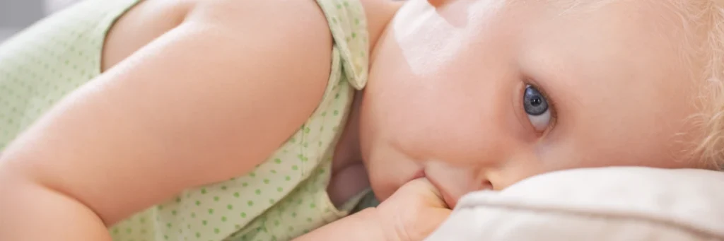 Ssanie kciuka u dzieci